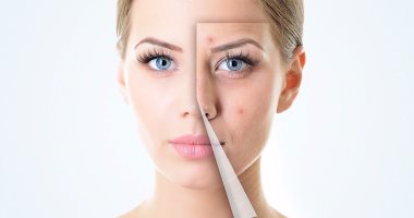 3 توابل فى مطبخك تخلصك من حب الشباب .. جوزة الطيب أهمها
