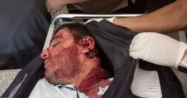 حداد يهشم رأس عامل "بشومه" لمعاكسته شقيقته بالخانكة 