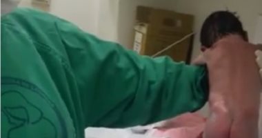 بالفيديو .. طفل برازيلى معجزة يسير على قدميه بعد ولادته مباشرة
