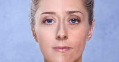 إزاى تتخلصى من الهالات السوداء بوصفات طبيعية