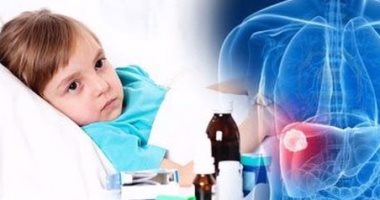 حاجات بتعملها من غير ما تحس ممكن تعرضك لفيرس سى.. اعرفها وابعد عنها  