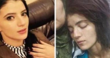 "ما بين الهوس والذهان" تشخيص الأطباء النفسيين لـ"فتاة العباسية".. ويؤكدون: الظهور الإعلامى لها تشهير وهى غير مسئولة عن تصريحاتها وتصرفاتها.. وطريقة حديثها المتقطع وموضوعاتها المتداخلة أبرز أعراض المرض