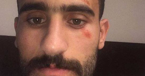 باسم مرسى ينشر أول صورة بعد نجاته من حادث بأكتوبر..ويؤكد: أنا كويس الحمدلله