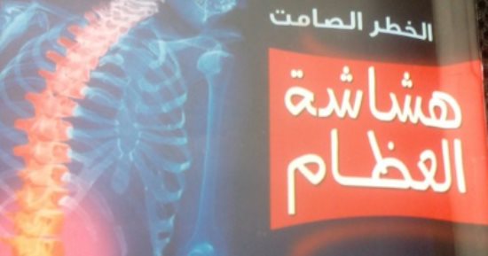 صدور كتاب "الخطر الصامت.. هشاشة العظام" عن سلسلة كتاب اليوم