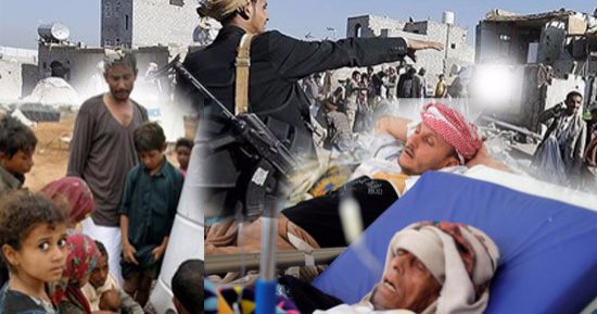 الأمم المتحدة: 17 مليون يمنى بحاجة للغذاء و7 ملايين يواجهون المجاعات