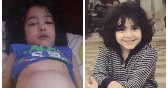 عملية زرع مضخة للقلب تنقذ الطفل ياسين..ووالدته: "كل الأبواب اتقفلت فى وشنا"