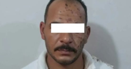 دنجوان كفر الشيخ اتحرق بماء النار.. عامل عاكس سيدة بالشارع فأحرق زوجها وجه