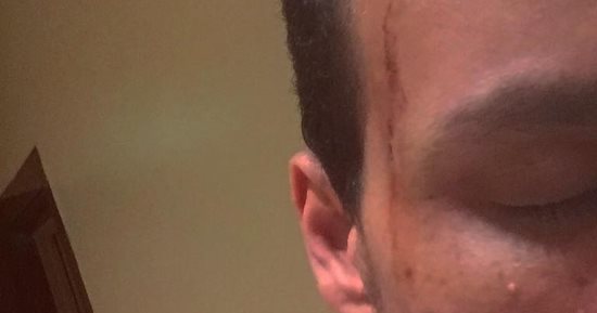 شاب يروى قصة تعرضه للسرقة تحت تهديد السلاح فى القاهرة الجديدة