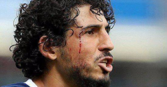 ملخص وأهداف فوز ويست بروميتش على بيرنلى 1-0 بمشاركة حجازى