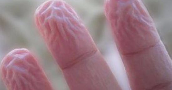اعرف ليه صوابعك بتكرمش فى المياه 