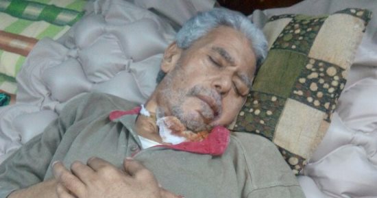 عم جابر  فى غيوبية بعد إزالة ورم خبيث وابنه يناشد "الصحة" لحجزه بالرعاية   