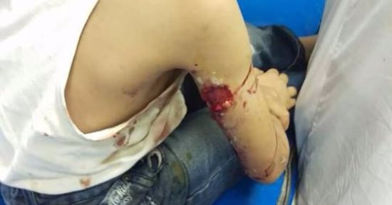 قارئ يشكو انتشار الكلاب الضالة فى أجا بالدقهلية وخطورتها على الأطفال 