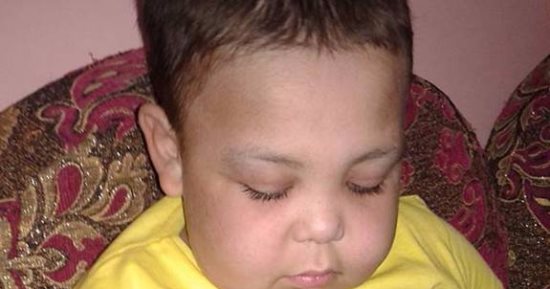 محمد يعيش مأساة بعدد أيام سنوات عمره الـ12 وأهله: لا نعرف له علاج