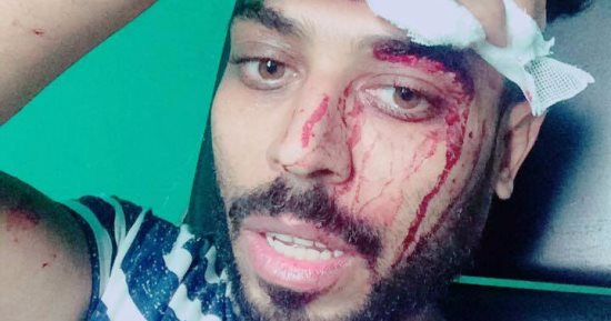 بالصور.. نجاة لاعب الحدود من الموت أثناء توجهه للتعاقد مع شربين 