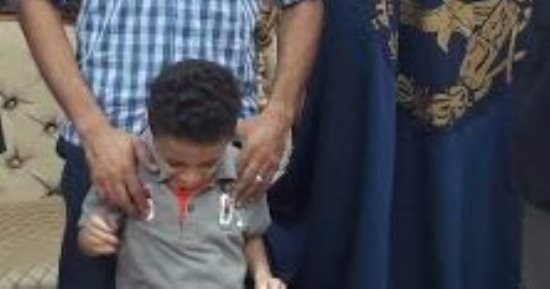 وزير الداخلية ينقذ طفلا من الموت بـ190 ألف جنيه لإجراء عملية بالقلب