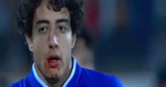 بالفيديو.. محمد هانى ينزف من "أنفه" فى مواجهة النجم الساحلى