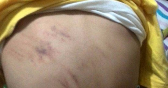 عرض التلميذ ضحية واقعة الجلد بمدرسة ميت مزاح على الطب الشرعي