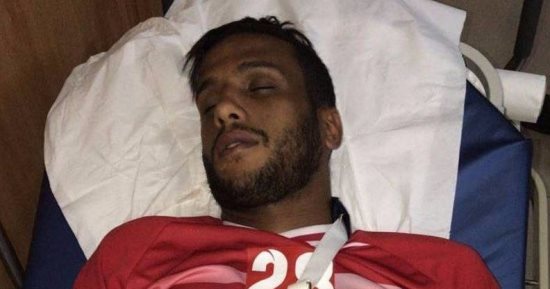 إسلام جمال يتحدث عن "شلل" الكتف وحصوله على 6 حقن مخدرة