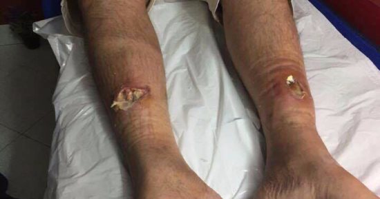 إصابة مواطن داخل لعبة ملاهى مائية بسبب عطلها فى شرم الشيخ