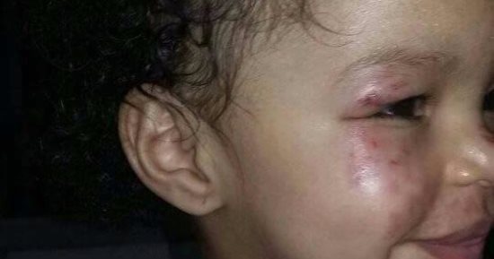 بالصور.. نيابة أسوان تحقق فى واقعة تعذيب طفلة داخل حضانة خاصة