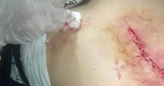 بالصور.. بلاغ يتهم 3 طلاب بالاعتداء على زميلهم داخل مدرسة بالدقهلية 