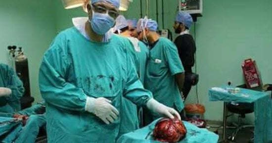 استئصال ورم من كلية مريض يزن 8 كيلو بمستشفيات جامعة المنوفية