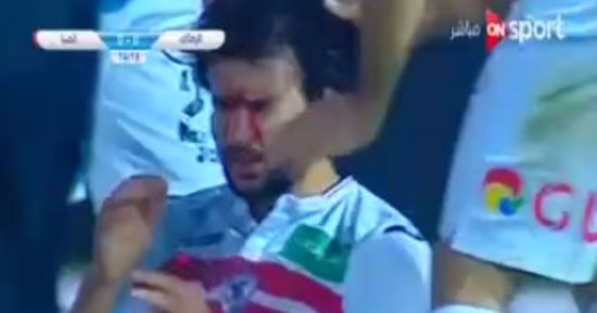 بالفيديو.. محمود علاء ينزف دما بعد التحام قوى أمام مرمى المنيا