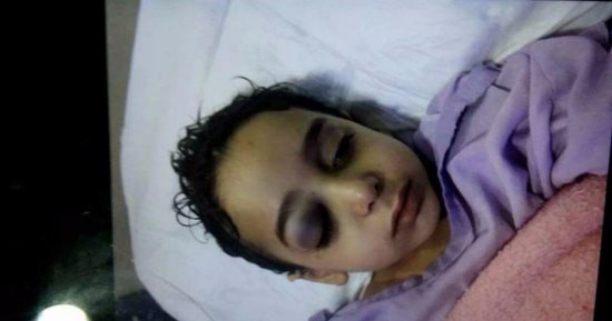 إصابة طفل بنزيف بالمخ وكسر بالجمجمة نتيجة طلق نارى طائش فى الدقهلية