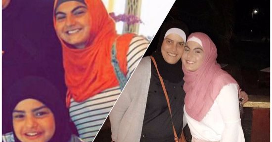حكاية شقيقتين تعانيان من فقدان الشعور بالألم بسبب مرض نادر