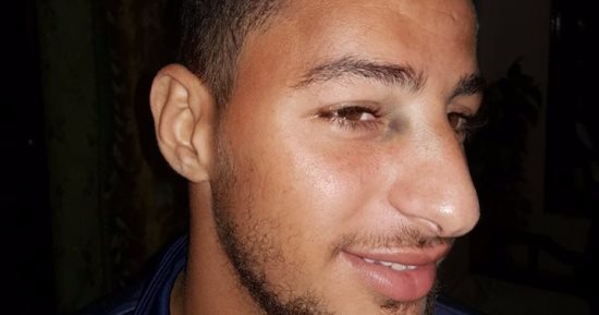 إصابة لاعب الأسيوطى بكدمة فى الوجه