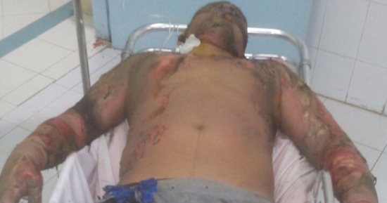 ‎تجديد حبس المتهم بحرق شاب معاق انتقاما منه فى الشرقية