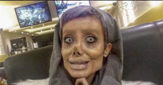 "مجنونة أنجلينا جولى" تتحول لهيكل عظمى بعد إجراء 50 عملية تجميل "صور"