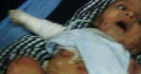 صور..مرض جلدى نادر ينهش فى جسد رضيعة.. وقارئة تطالب وزارة الصحة بعلاجها