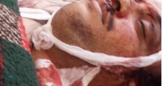 تداول صور الأمين العام المساعد لحزب المؤتمر الشعبى فى اليمن بعد مقتله