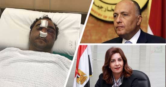 وزيرة الهجرة تطير للكويت لمتابعة تطورات الاعتداء على الشاب المصرى.. تلتقى وزيرة العمل الكويتية وتؤكد: الحادث فردى.. الضحية: طلب تصليح دراجته وضربنى.. الأمن يضبط الجانى.. والخارجية: سنظل بجوارك حتى نيل حقوقك