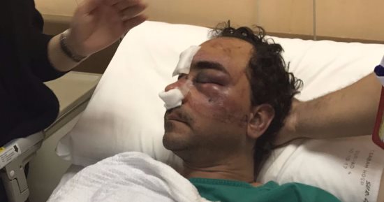 سفير مصر بالكويت للمواطن المعتدى عليه: نتابع التحقيقات مع السلطات المعنية