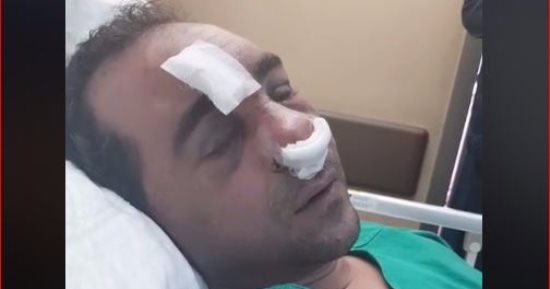 القوى العاملة: المصرى المصاب بالكويت غادر المستشفى وحقوقه محفوظة