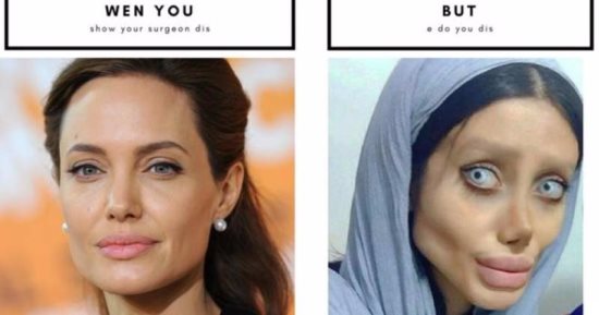 BBC: الإيرانية صاحبة ادعاء إجراء 50 عملية للتشبه بأنجلينا جولى "كاذبة"
