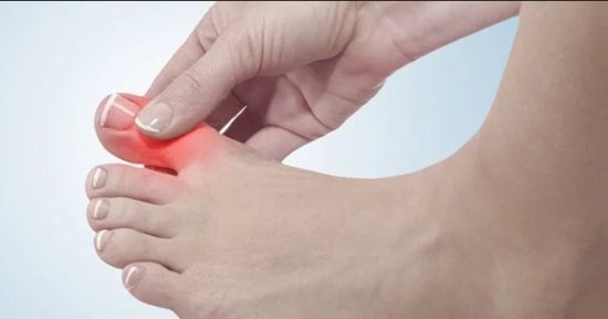 روشتة للتخلص من آلام النقرس خلال 3 أسابيع.. تعرف عليها