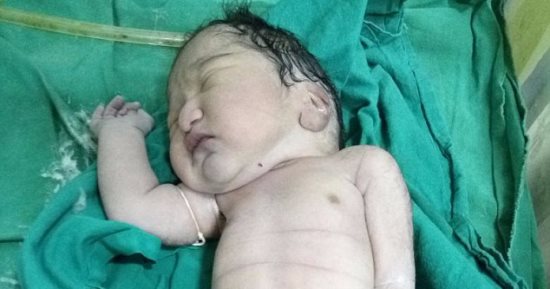ديلى ميل: أم تنجب "حورية بحر" وتموت بعد 4 ساعات فقط.. صور