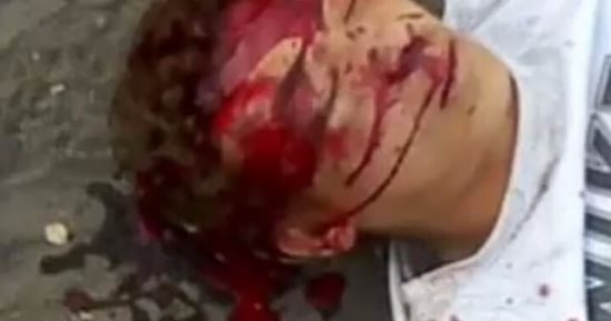 عصابة تهشم رأس طفلا للاستيلاء على توك توك بعد استدراجه لطريق الدهشورية