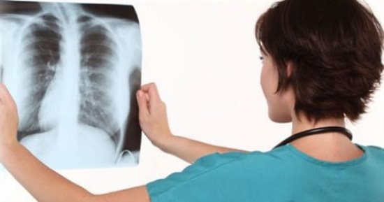 تطوير اختبار جديد للكشف المبكر عن مرض السل