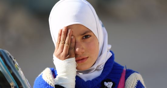 صور.. أطفال سوريا يتضامنون مع طفل فقد عينه وتحطمت جمجمته فى الغوطة