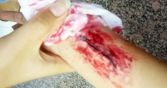 قارئة تشارك "اليوم السابع" تصميماتها فى عمل الكدمات والخدع السينمائية