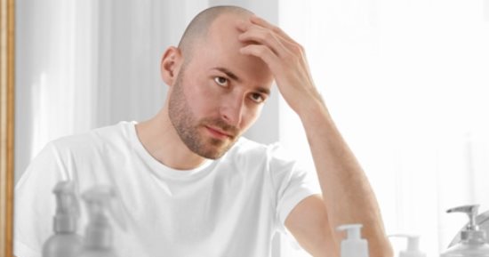 تعرف على أحدث طرق علاج الصلع عند الرجال