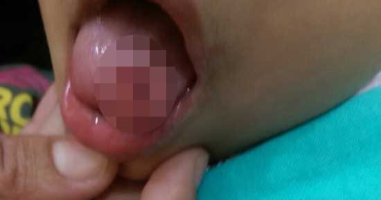 ربة منزل تحرر محضرا لحضانة خاصة تسببت فى قطع لسان طفلتها بالمنصورة