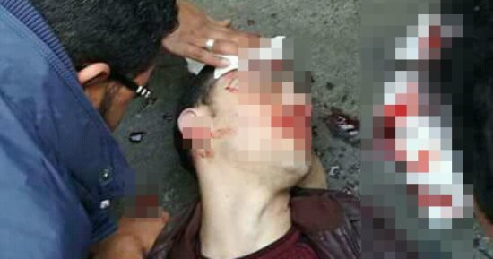 قارئ يرصد إصابة طالب أثناء عبوره طريق جامعة الأزهر ومطالب بـ"كوبرى مشاة"