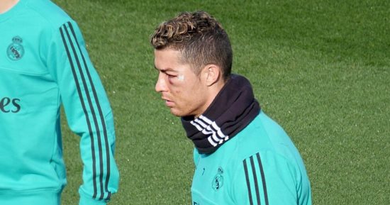 شاهد.. رونالدو فى أول مران مع ريال مدريد بعد الإصابة الدموية