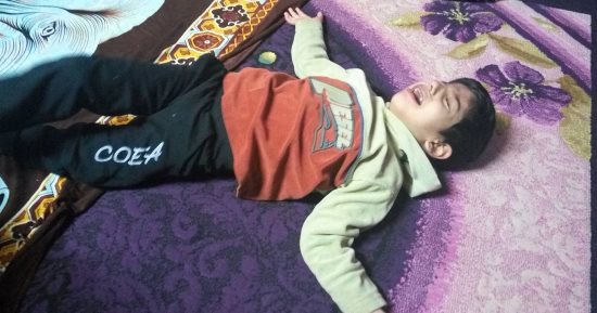 صور.. "آدم" أصيب بفقد البصر والحركة ويحتاج زراعة خلايا جذعية خارج مصر