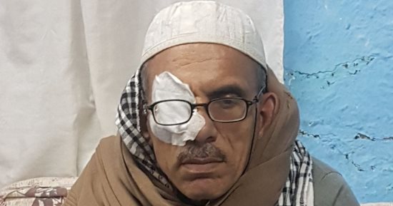 مريض بالكبد فى الشرقية: نفسى فى مشروع يكفينى شر السؤال